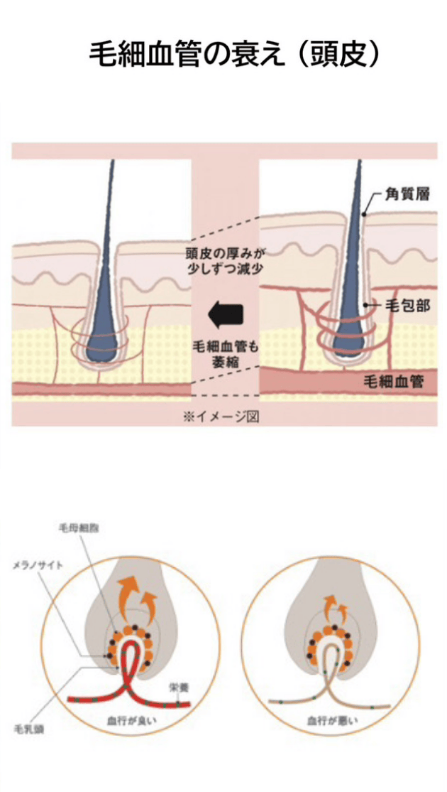 毛細血管の衰え（頭皮）